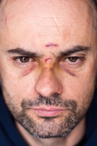 personal injury lawyer atlanta GA