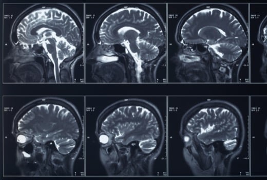 Charlotte NC car accident lawyer