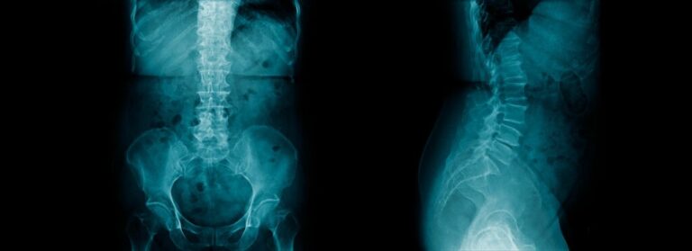 Back X-Ray