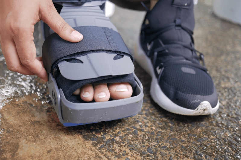 foot injury